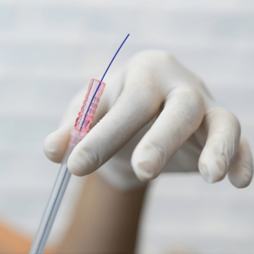 Fio Filler em Ceilândia