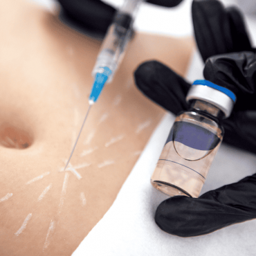 Lipo Injection (Enzimas Redutoras) em Ceilândia