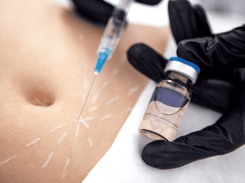 Lipo Injection (Enzimas Redutoras)